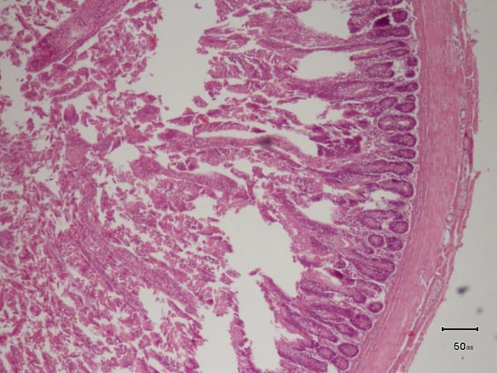Antibiotic · jejunum histology micrograph
