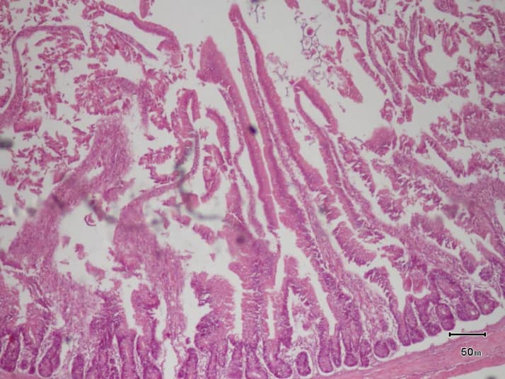 Essync · duodenum (40×) histology micrograph